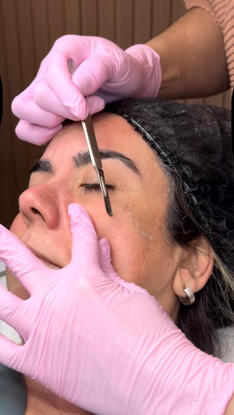 Close view of a dermaplaning session: a gloved hand guides a fine blade across a client’s cheek.
