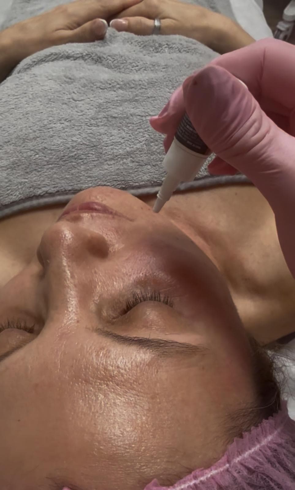 Close view of a serum being applied to a client’s face.